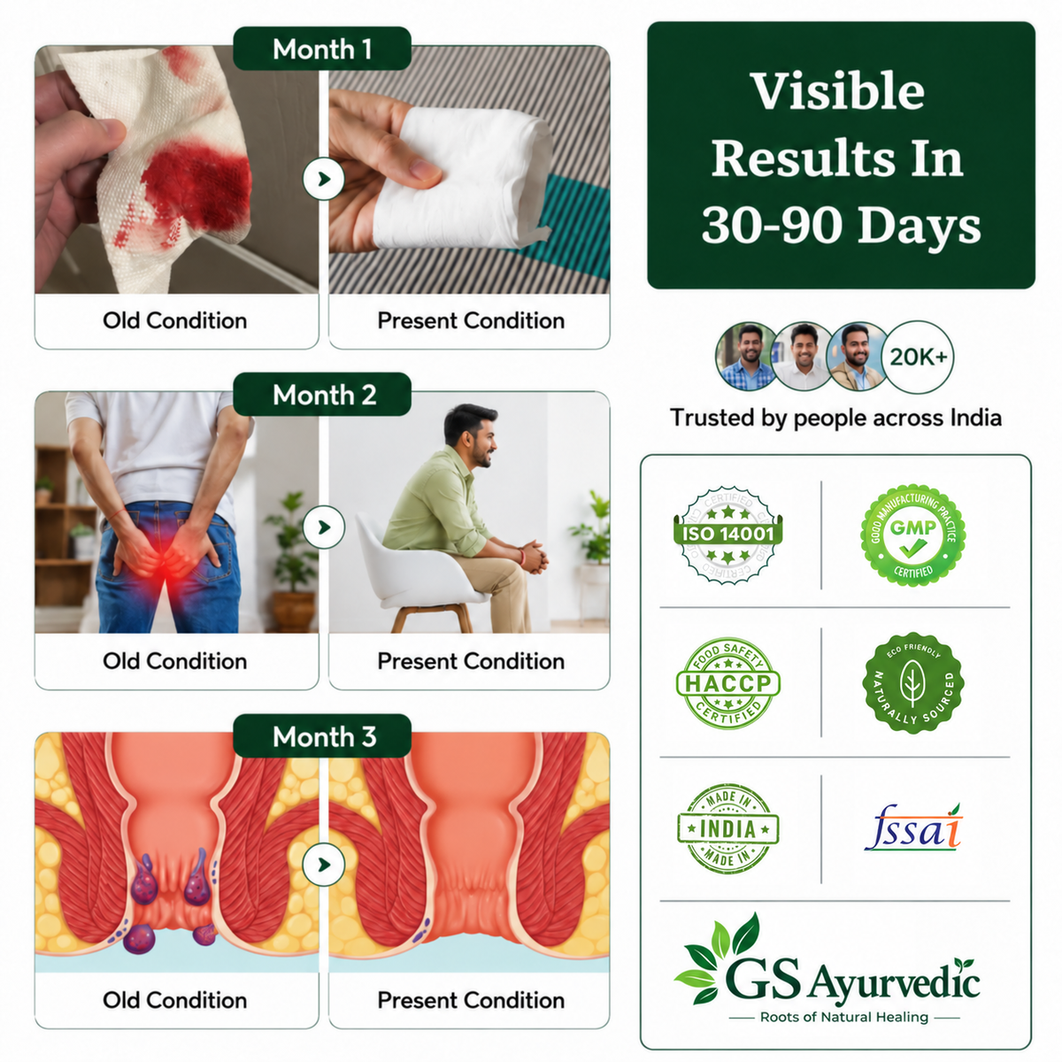 GS Ayurvedic Pilo Care | Piles Pain, Bleeding & Swelling Relief | 60+ Years Expertise